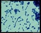 Enterococcus faecalis microscopy